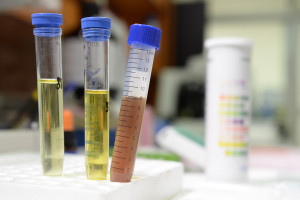 Scientist doing chemical test in laboratory